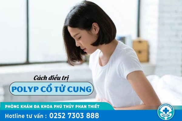Cách điều trị polyp cổ tử cung hiện nay