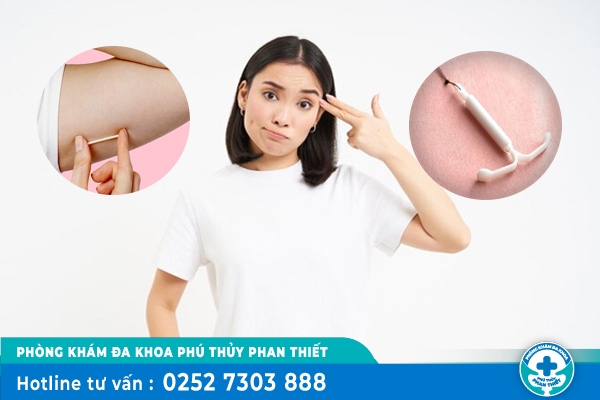 Nên đặt vòng hay cấy que để tránh thai hiệu quả?