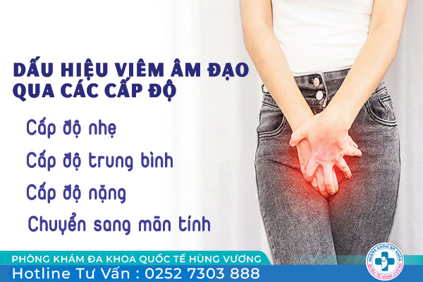 Nhận diện dấu hiệu viêm âm đạo qua các cấp độ