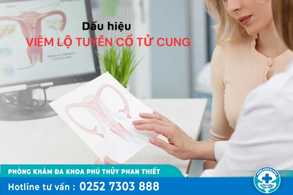 Những dấu hiệu viêm lộ tuyến cổ tử cung và phương pháp điều trị