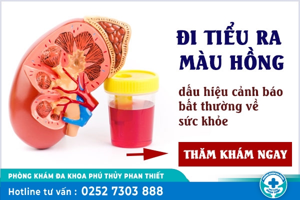 Đi tiểu ra màu hồng ở nữ là bị bệnh gì? Cách khắc phục hiệu quả?
