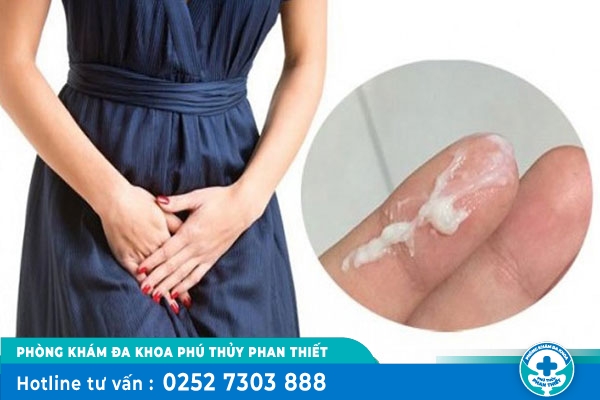 Huyết trắng vón cục cảnh báo bệnh gì?