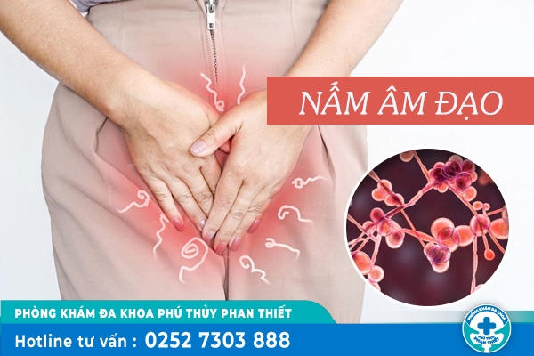 Nhận biết nấm âm đạo và các mức độ nguy hiểm
