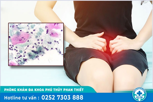 Nhận biết nấm phụ khoa và các mức độ nguy hiểm