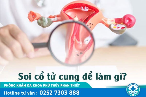 Soi cổ tử cung là gì và khi nào nên thực hiện?