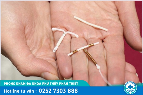 Tháo vòng tránh thai như thế nào? - Địa chỉ tháo vòng an toàn, hiệu quả