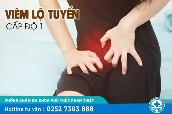 Phương pháp điều trị viêm lộ tuyển cấp độ 1 hiệu quả