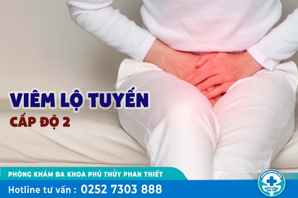 Biểu hiện của viêm lộ tuyến cấp độ 2